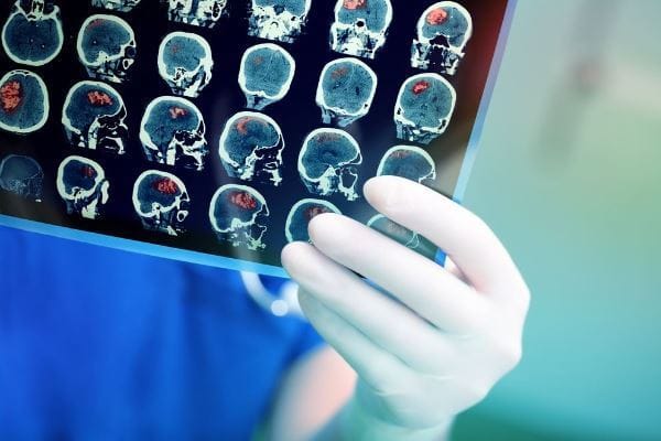 doctor examining a film of a persons head
