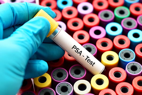 psa test vial