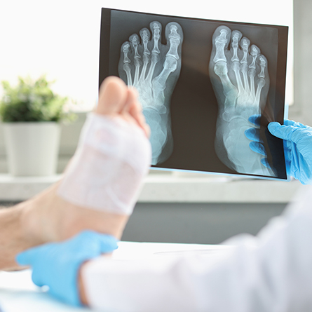 x-ray of two feet