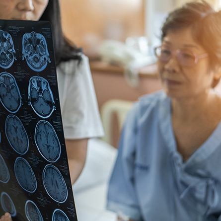 Reviewing Brain Scan
